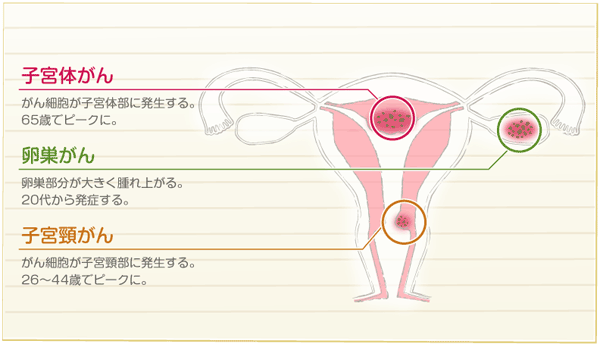 がんの種類